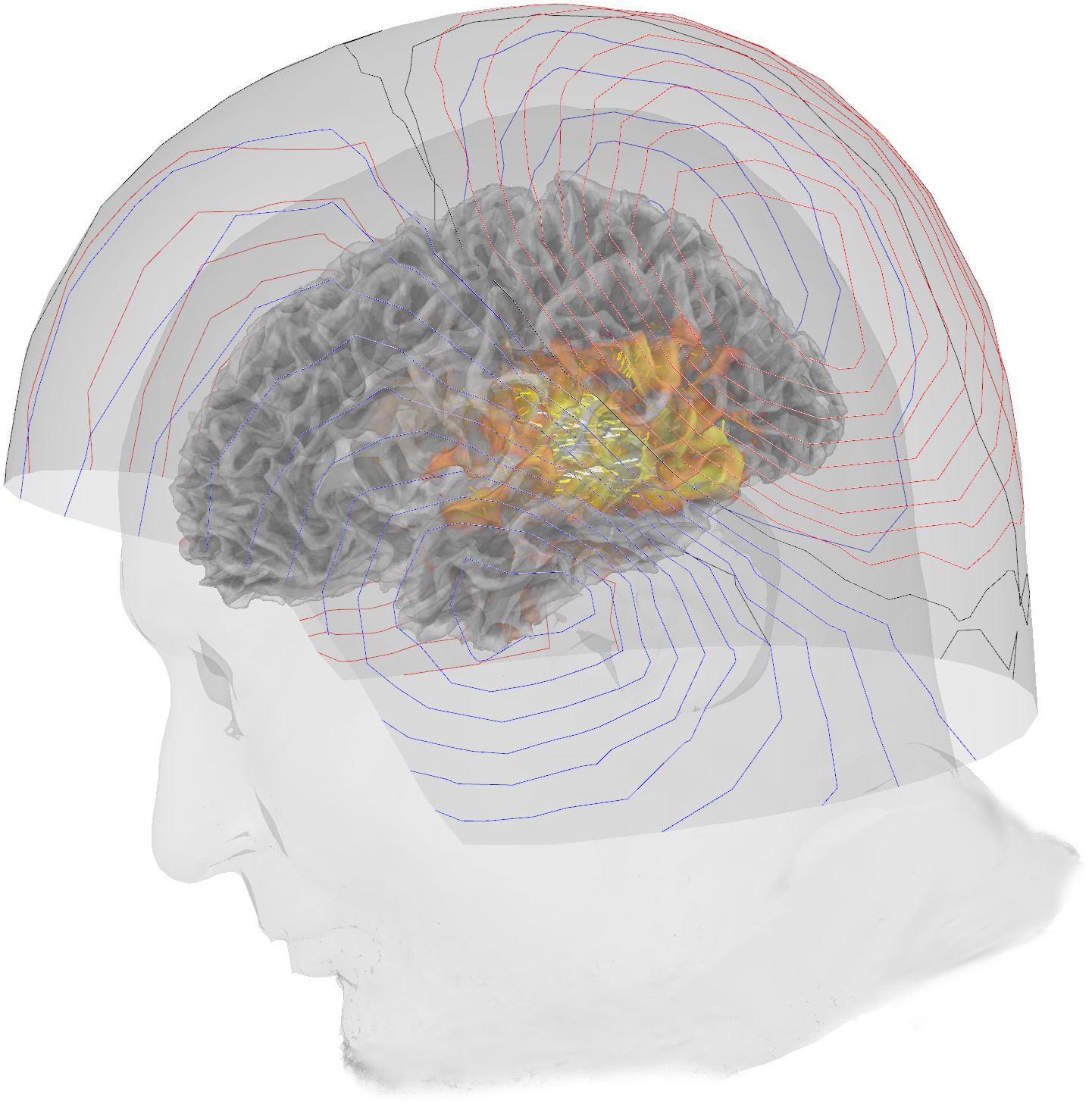 image showing magnetic fieldlines recorded from the brain